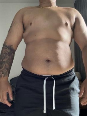 Onbewerkte foto van een cliënt met tattoo-sleeve vóór het traject